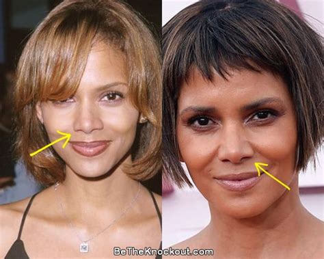 halle berry chirurgie